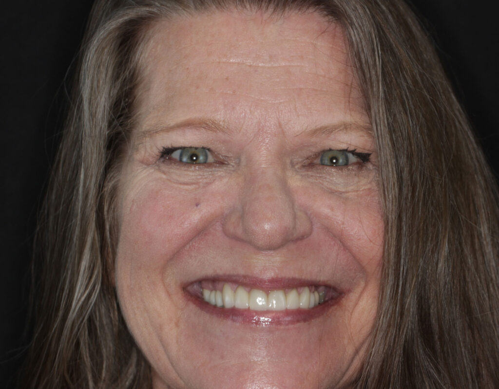 SusanFace-Post2