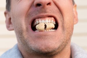 man opening nut with teeth
